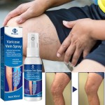 Varicose Vein Treatment Spray