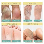 3W Clinic Enrich Foot Treatment Cream (Made in Korea)