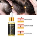 EELHOE Fast Hair Growing Oil